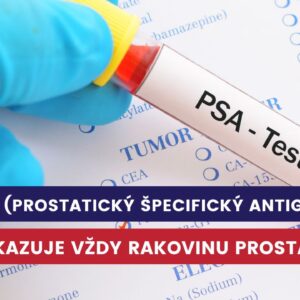 PSA, prostatický špecifický antigén