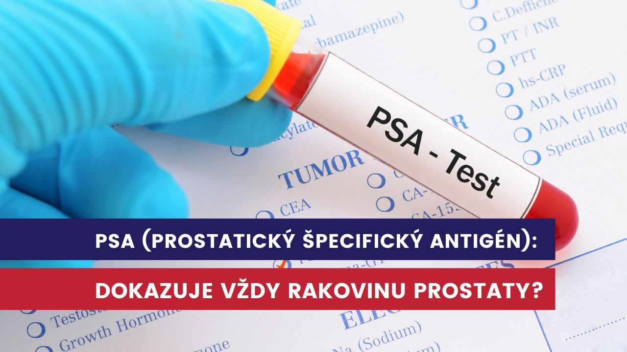 PSA, prostatický špecifický antigén